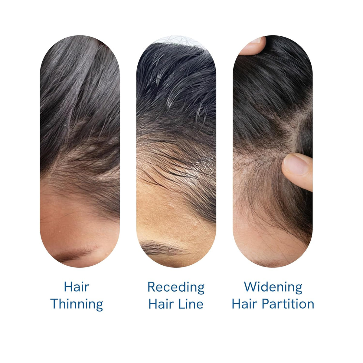 🔥NOW 50% OFF!! 🔥NEGUSY Hair Growth Serum Roll-On: 🌿The Scalp-Supporting Solution for Thicker, Fuller Hair✨